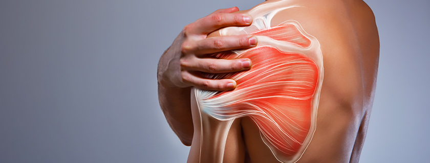 الأسئلة الشائعة حول آلام الكتف والرقبة