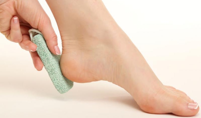 Симптомы пяточной шпоры