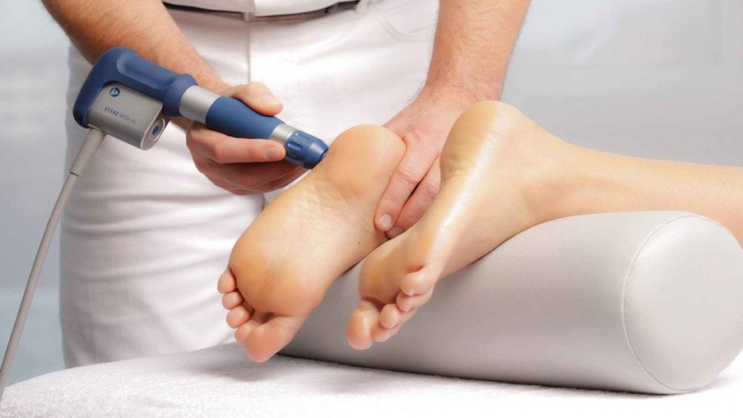 Лечение пяточной шпоры