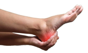 Лечение пяточной шпоры