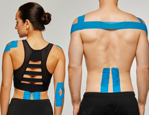 Тейпирование ортопедического лечения